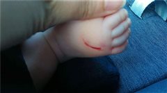 Συνελήφθη η γυναίκα που χαράκωνε βρέφη!