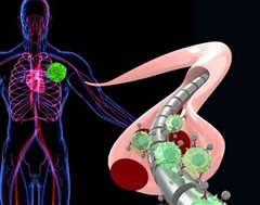 Μαγνητικό καλώδιο ανιχνεύει τον καρκίνο!